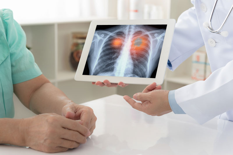 Mesothelioma or Lung Cancer? We Can Help.